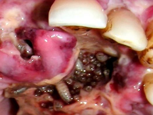 Dentes Podres