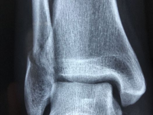 Radiografia
