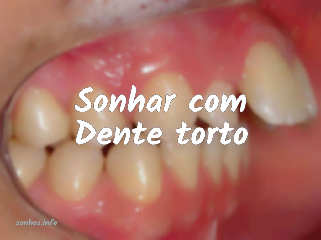 Featured image of post Sonhar Com Dente Torto Sonhar com dente podre caindo